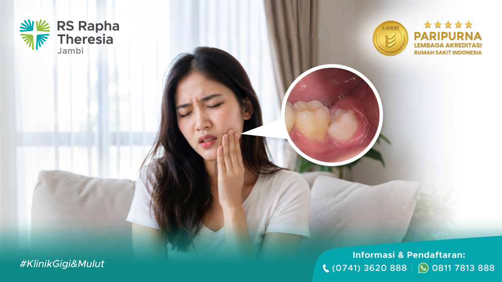 Mengenal Penyebab & Tanda Gigi Bungsu Bermasalah